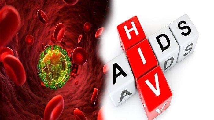 HIV dan AIDS