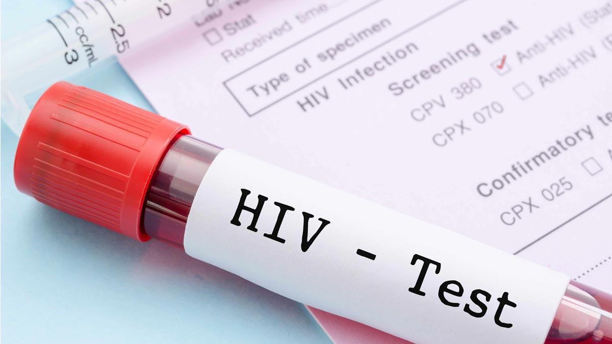 Kapan sebaiknya menjalani tes HIV ?